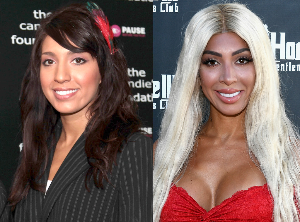 Photos From Celebs Who Ve Admitted To Getting Plastic Surgery E